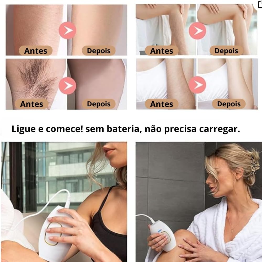 Depilador a Laser Portati Profissional - Removedor De Pelos Permanente e Indolor